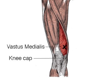 vastus-med